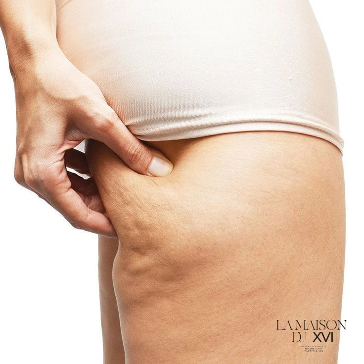 Kill Cellulite par Zone Paris 16